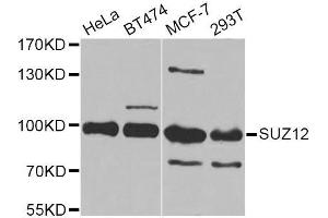 Western blot analysis of extracts of various cell lines, using SUZ12 Antibody (ABIN5975314) at 1/1000 dilution. (SUZ12 anticorps)