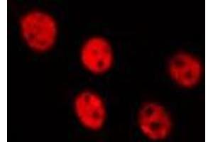 ABIN6275507 staining HepG2 by IF/ICC. (RFWD3 anticorps  (N-Term))