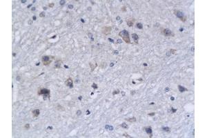 Formalin-fixed and paraffin embedded rat brain tissue labeled with Anti-Bak Polyclonal Antibody, Unconjugated (ABIN674409) followed by conjugation to the secondary antibody and DAB staining (BAK1 anticorps  (AA 21-120))