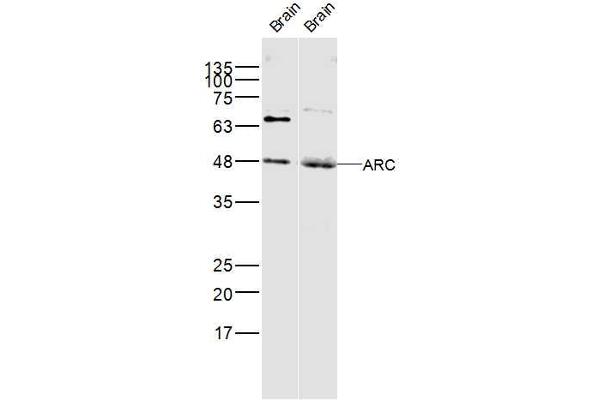 Arc anticorps  (AA 101-200)