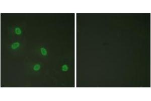 Immunofluorescence analysis of HeLa cells, using PPAR-BP (Phospho-Thr1457) Antibody. (PPAR-BP (AA 1423-1472), (pThr1457) anticorps)