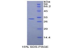 SDS-PAGE analysis of Mouse Transaldolase Protein. (TALDO1 Protéine)