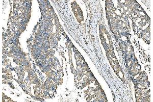 IHC analysis of IMPDH1 using anti-IMPDH1 antibody (ABIN7599864). (IMPDH1 anticorps  (AA 123-500))