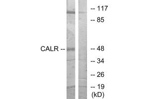 Western blot analysis of extracts from COS-7 cells, using CALR antibody. (Calreticulin anticorps  (N-Term))