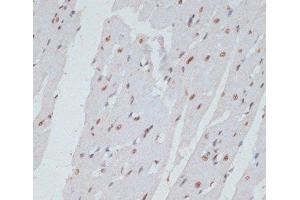 Immunohistochemistry of paraffin-embedded Rat heart using Phospho-ERK1(T202/Y204)/ ERK2(T185/Y187) Polyclonal Antibody at dilution of 1:100 (40x lens).