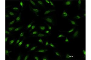 Immunofluorescence of monoclonal antibody to TBL1XR1 on HeLa cell. (TBL1XR1 anticorps  (AA 81-178))