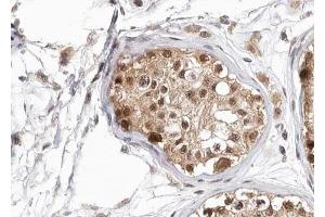 ABIN6267694 at 1/100 staining human testis tissue sections by IHC-P. (HDAC6 anticorps  (pSer22))