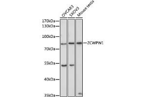 Western blot analysis of extracts of various cell lines, using ZCWPW1 antibody (ABIN6133087, ABIN6150412, ABIN6150413 and ABIN6223508) at 1:1000 dilution. (ZCWPW1 anticorps  (AA 389-648))