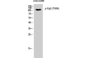Western Blotting (WB) image for anti-Kinesin Family Member 11 (KIF11) (pThr926) antibody (ABIN5961163) (KIF11 anticorps  (pThr926))