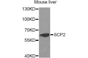 Western blot analysis of extracts of mouse liver, using SCP2 Antibody.