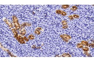 Detection of CK5 in Rat Parotid Gland Tissue using Polyclonal Antibody to Cytokeratin 5 (CK5)