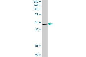 SMARCB1 monoclonal antibody (M01), clone 3E10.