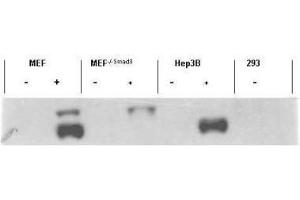Western blot using  affinity purified anti-Smad3 pS423 pS425 antibody shows detection of endogenous Smad3 in stimulated cell lysates. (SMAD3 anticorps  (pSer423, pSer425))