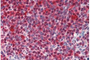 Human Spleen (formalin-fixed, paraffin-embedded) stained with HSPA8 antibody ABIN462103 at 10 ug/ml followed by biotinylated secondary antibody, alkaline phosphatase-streptavidin and chromogen. (Hsc70 anticorps)