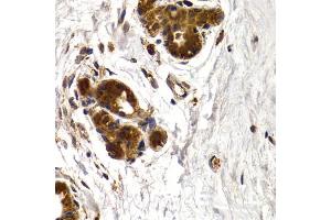 Immunohistochemistry of paraffin-embedded human mammary gland using CTSS antibody. (Cathepsin S anticorps)