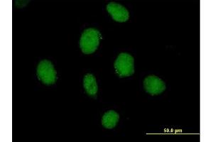 Immunofluorescence of purified MaxPab antibody to SDCCAG10 on HeLa cell.