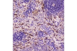 IHC analysis of C Reactive Protein using anti-C Reactive Protein antibody (ABIN5692861). (CRP anticorps  (AA 20-230))