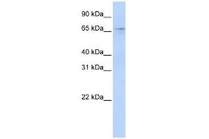 A1CF antibody used at 1 ug/ml to detect target protein. (A1CF anticorps  (N-Term))