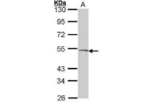 WB Image Sample (30 ug of whole cell lysate) A: Hela 10% SDS PAGE antibody diluted at 1:1000 (VIPR2 anticorps  (C-Term))