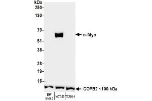 Western Blotting (WB) image for anti-N-Myc Proto-Oncogene Protein (MYCN) (AA 100-150) antibody (ABIN7795786) (Recombinant MYCN anticorps  (AA 100-150))