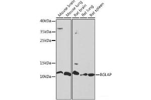 Western blot analysis of extracts of various cell lines using BGLAP Polyclonal Antibody at dilution of 1:1000. (Osteocalcin anticorps)