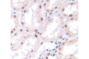 Used in DAB staining on fromalin fixed paraffin- embedded Kidney tissue