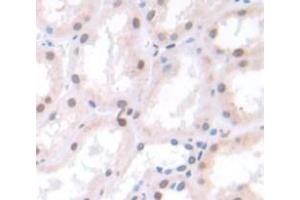 Used in DAB staining on fromalin fixed paraffin- embedded Kidney tissue (Spt6 anticorps  (AA 532-666))