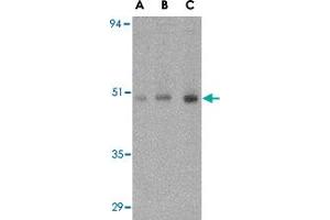 Western blot analysis of ORAI1 in human ovary tissue lysate with ORAI1 polyclonal antibody  at (A) 0. (ORAI1 anticorps  (C-Term))