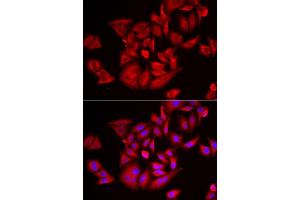 Immunofluorescence analysis of U2OS cell using TLK2 antibody. (TLK2 anticorps)