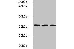 Western blot All lanes: FTSJ1 antibody at 2 μg/mL Lane 1: HepG2 whole cell lysate Lane 2: Mouse brain tissue Lane 3: EC109 whole cell lysate Secondary Goat polyclonal to rabbit IgG at 1/15000 dilution Predicted band size: 37, 36 kDa Observed band size: 37 kDa (FTSJ1 anticorps  (AA 1-329))