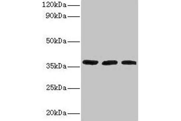 FTSJ1 anticorps  (AA 1-329)