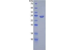 SDS-PAGE of Protein Standard from the Kit  (Highly purified E. (Angiopoietin 2 Kit ELISA)