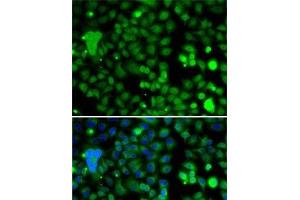Immunofluorescence analysis of A-549 cells using KLF9 Polyclonal Antibody (KLF9 anticorps)