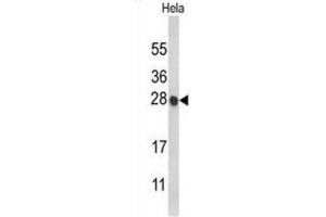 Western Blotting (WB) image for anti-Histone Cluster 1, H1c (HIST1H1C) antibody (ABIN3004061) (HIST1H1C anticorps)