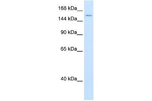 WB Suggested Anti-DHX9 Antibody Titration:  0. (DHX9 anticorps  (N-Term))