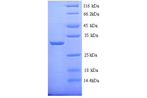 CA1 Protein (AA 2-261, full length) (His tag)
