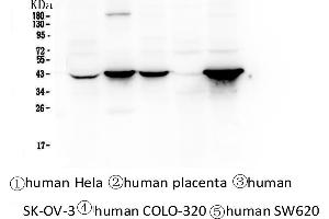 Western blot analysis of Cytokeratin 19 using anti-Cytokeratin 19 antibody .