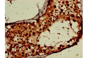 IHC image of ABIN7168497 diluted at 1:600 and staining in paraffin-embedded human testis tissue performed on a Leica BondTM system.