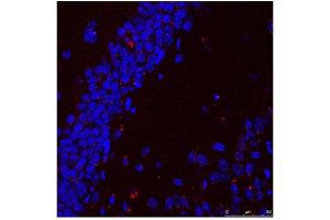 Sample Type :  Human brain stem cells  Primary Antibody Dilution :  1:500  Secondary Antibody :  Goat anti-rabbit Alexa-Fluor 594  Secondary Antibody Dilution :  1:1000  Color/Signal Descriptions :  HSPA9: Red DAPI:Blue  Gene Name :  HSPA9  Submitted by :  Dr.