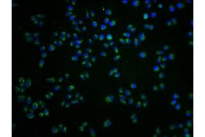 Immunofluorescence staining of Hela cells with ABIN7168054 at 1:100, counter-stained with DAPI. (GRK7 anticorps  (AA 342-550))