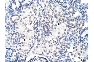 NIP7 antibody was used for immunohistochemistry at a concentration of 4-8 ug/ml to stain Epithelial cells of renal tubule (arrows) in Human Kidney. (NIP7 anticorps)