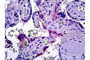 Anti-DOK3 antibody IHC of human placenta. (DOK3 anticorps  (AA 484-496))