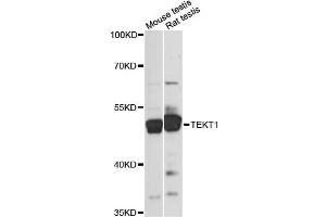 Western blot analysis of extracts of various cell lines, using TEKT1 antibody (ABIN6290784) at 1:1000 dilution. (TEKT1 anticorps)