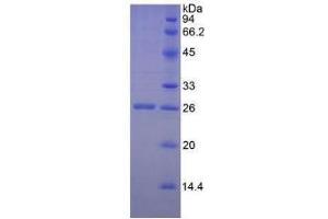 SDS-PAGE of Protein Standard from the Kit (Highly purified E. (GZMM Kit ELISA)