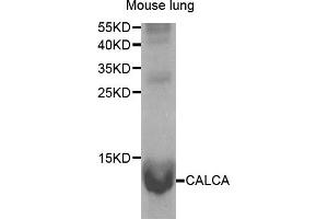 Western Blotting (WB) image for anti-Calcitonin-Related Polypeptide alpha (CALCA) antibody (ABIN1876765) (CGRP anticorps)