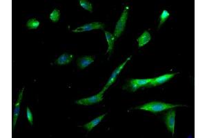 Image provided by One World Lab validation program. (Integrin Alpha3, Beta1 (AA 976-1025) anticorps)