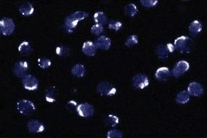Immunofluorescent staining of Jurkat cells. (BCL2L1 anticorps  (AA 18-233))