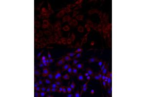 Immunofluorescence analysis of PC-12 cells using PI3 Kinase p85 alpha antibody (ABIN6130617, ABIN6145642, ABIN6145645 and ABIN6215197) at dilution of 1:100. (PIK3R1 anticorps  (AA 240-380))