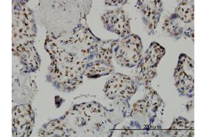Immunoperoxidase of monoclonal antibody to TAF7 on formalin-fixed paraffin-embedded human placenta.
