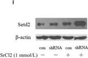 HnRNPL has negative effect on PDLCs osteogenic differentiation.